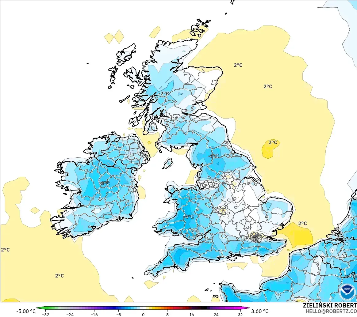 GFS model - Britania Raya, Anomali Suhu 2 m